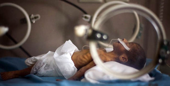 یونسیف: مرگ و میر اطفال نوزاد در افغانستان کاهش یافته‌است
